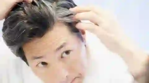Hair care of सफेद बालों से चाहिए छुटकारा तो डाइट में शामिल करें ये 5 चीजें, 